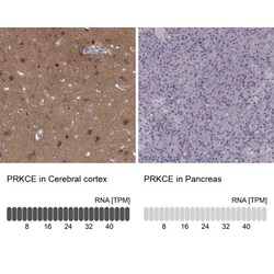 PKC epsilon Antibody, Novus Biologicals 0.1mL; Unlabeled:Antibodies, Polyclonal